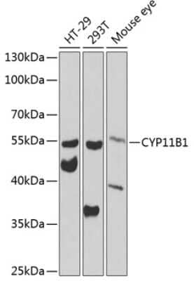 Western Blot: CYP11B1 AntibodyBSA Free [NBP2-92509]